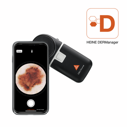 HEINE DELTAone Dermatoskop - Edition SCHWARZ